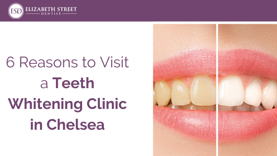 Teeth whitening chelsea