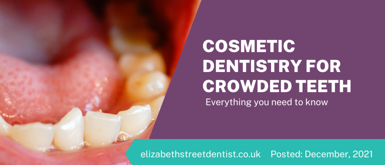 Cosmetic Dentistry For Crowded Teeth - Everything You Need To Know