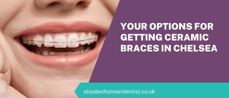 Your Options For Getting Ceramic Braces In Chelsea