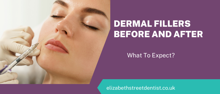 Dermal Fillers Before And After - What To Expect?